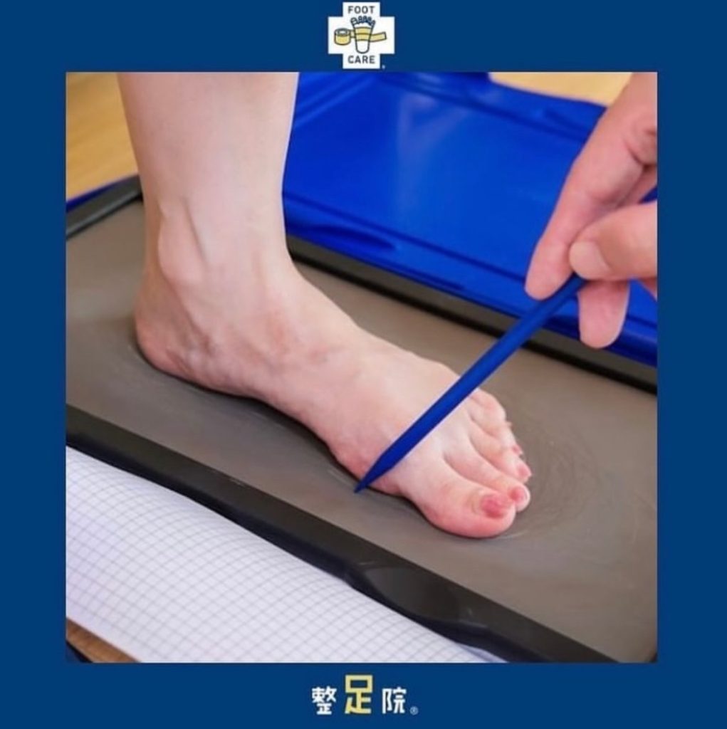 足の測定をすることにより見えてくるものがある