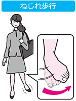 ねじれ歩行による様々な弊害について