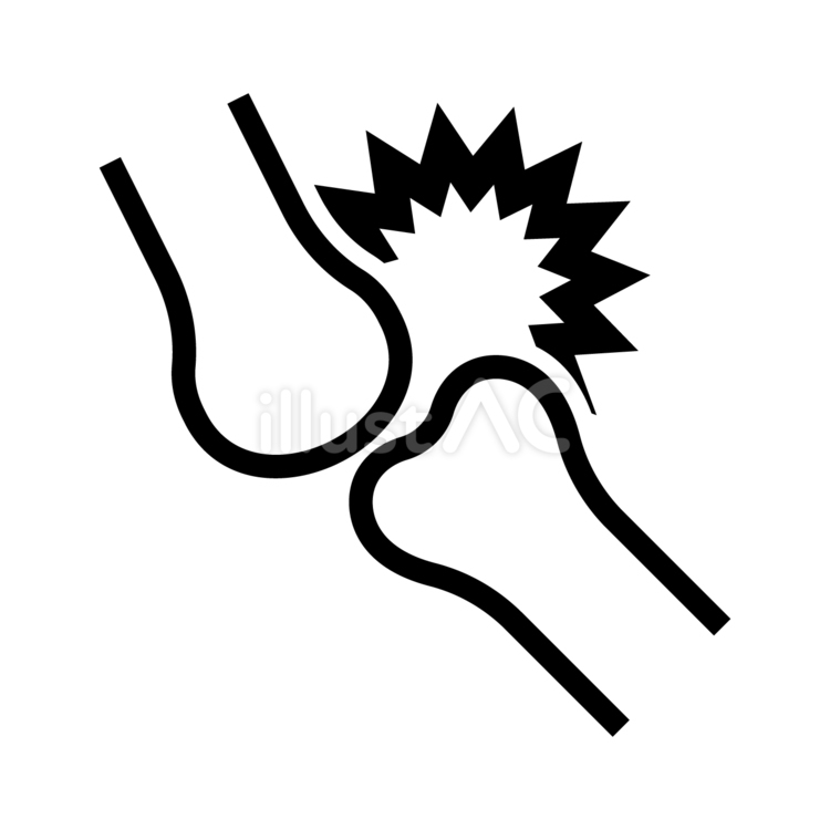 足のゆびの浮き脱臼と言われる状態について解説します